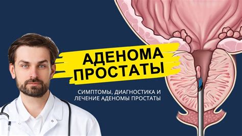 Аденома простаты и ее симптомы 