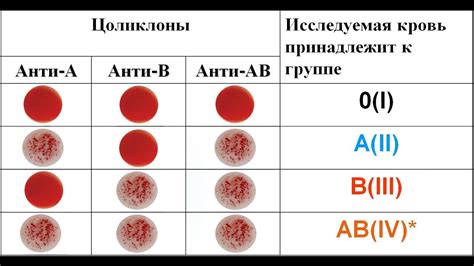 Анализ крови: как определить группу крови