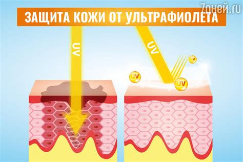 Безопасные способы загара для людей с родимыми пятнами