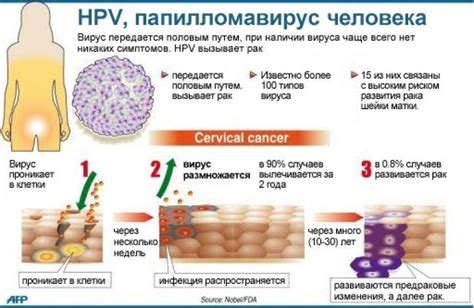 ВПЧ: что это такое и каковы симптомы