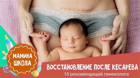 Важные моменты при занятиях растяжкой после кесарева