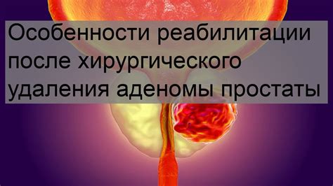 Велосипедный спорт после удаления простаты