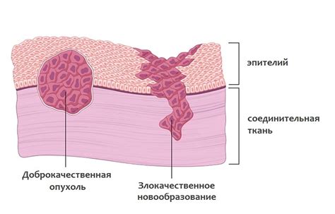 Влияние биопсии на рост опухоли