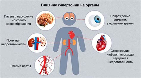 Влияние гипертонии на вождение