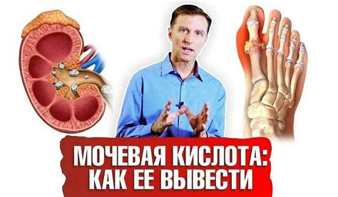 Влияние грецких орехов на уровень мочевой кислоты