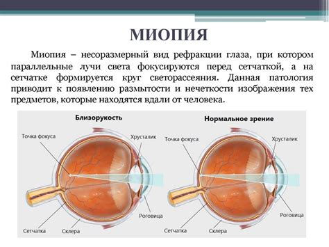 Влияние миопии на показатели крови