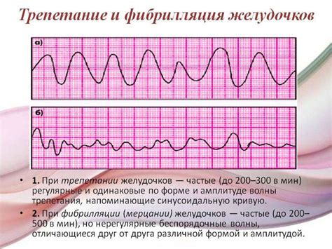 Влияние на скорость сердечного ритма