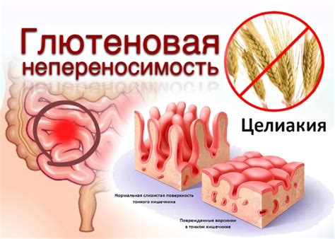 Влияние резких изменений в питании на новорожденного