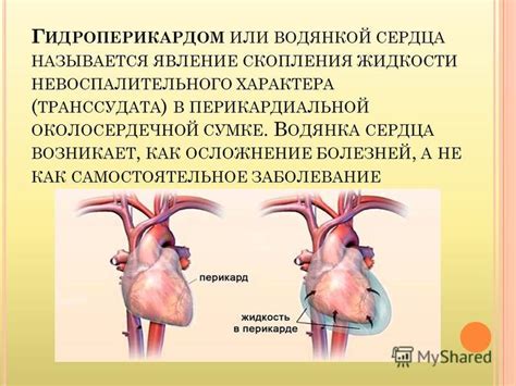 Возможные причины гидроперикарда у женщин