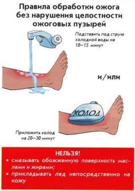 Второй шаг: обработка ожога антисептиком