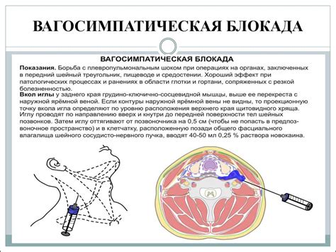 Двухсторонняя единовременная вагосимпатическая блокада: преимущества и возможности