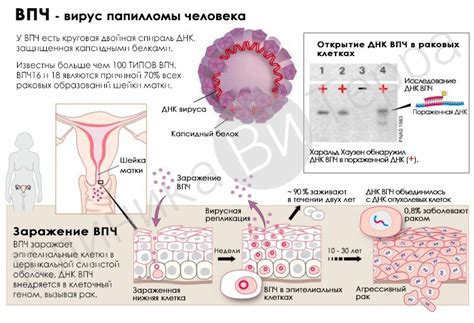 Диагностика ВПЧ: как определить наличие вируса