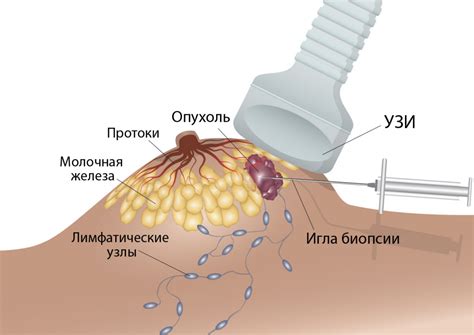 Дополнительные исследования после биопсии