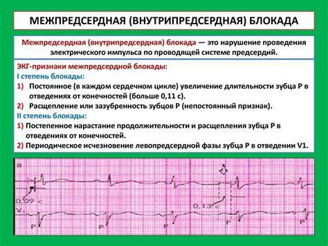 Допустимые виды спорта при нарушении внутрижелудочковой проводимости