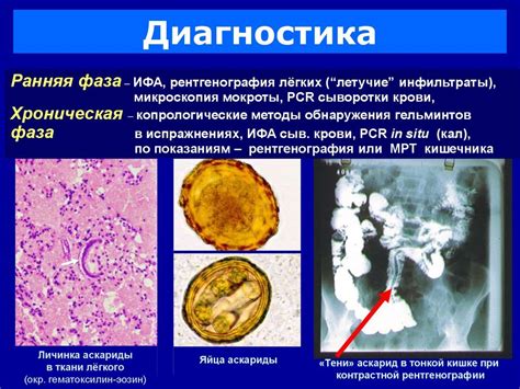 Другие методы обнаружения глистов