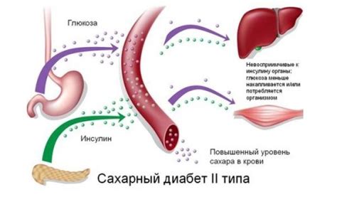 Изменение образа жизни при лечении второго типа сахарного диабета