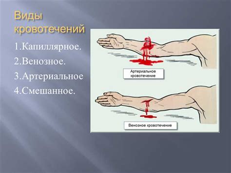 Имплантационные кровотечения и их возможные последствия