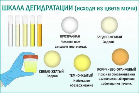 Интересно узнать соотношение цвета мочи с приемом Канефрона.