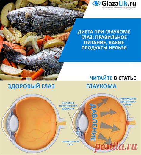 Какие методы сохранения зрения при глаукоме существуют?