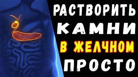 Какие препараты помогут вывести камни из желчного пузыря?