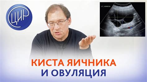 Какой яичник овулирует, если два яичника функционируют?