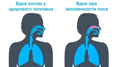 Как Супрастин помогает справиться с заложенностью носа: полезные советы