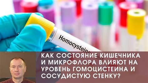 Как кальмары влияют на состояние кишечника