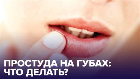 Как передается простуда на губах?