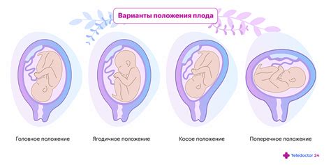 Как позиция мамы влияет на положение ребенка внутри утробы?