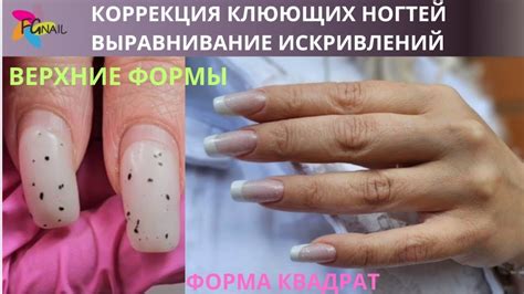 Ключевые признаки клюющих ногтей