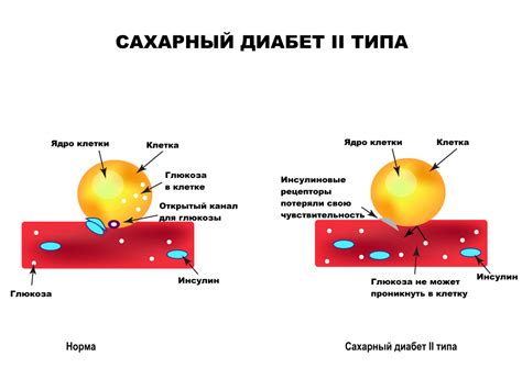 Коллаген и его влияние на сахарный диабет 2 типа