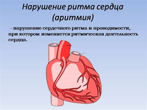 Консультация врача: что делать, если возникла аритмия в связи с глистами