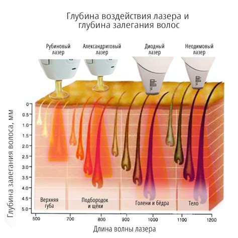 Лазерная эпиляция при мастопатии: действие и эффективность