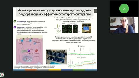 Лекарственная терапия муковисцидоза взрослого