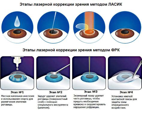 Лечебные процедуры: лазерная коррекция зрения и другие