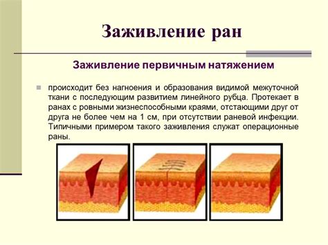 Лечение инфекций и ран