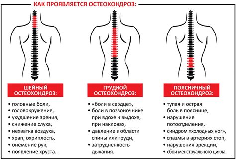 Лечение кружения головы от спины