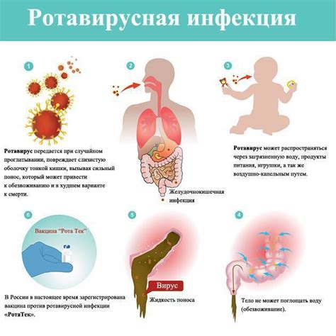 Лечение ротовирусной инфекции у взрослых