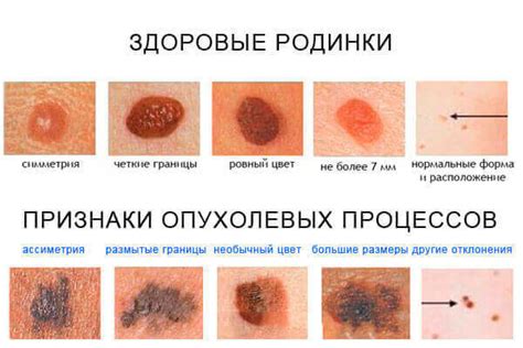 Медицинское толкование: понимание заболеваний на коже