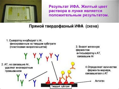 Методы диагностики уреаплазмы