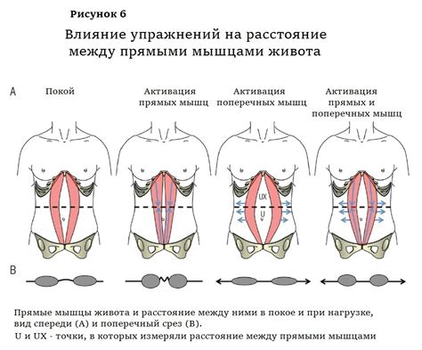 Метод 5: Пальпация прямых мышц живота