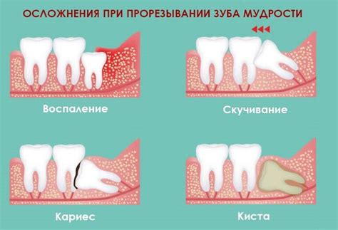 Мечты о выдирании зуба: интерпретация символики