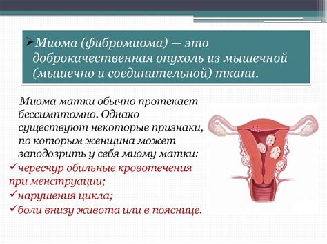 Миома матки: особенности, симптомы и последствия