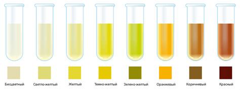 Может ли окраска мочи в коричневый цвет после чая быть признаком проблемы со здоровьем?