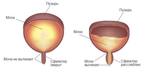 Может ли почка лопнуть у человека?