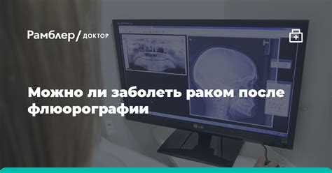 Можно ли сделать КТ после флюорографии?