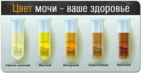 Моча как альтернатива медикаментам