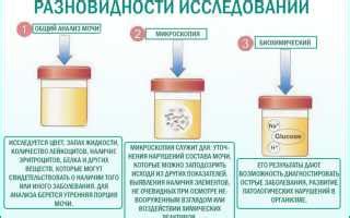 Обнаружение следов никотина в моче