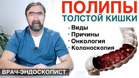 Опасности удаления полипов в толстой кишке