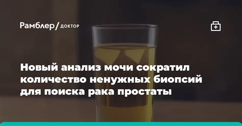 Оптимальное количество биопсий простаты для точной диагностики